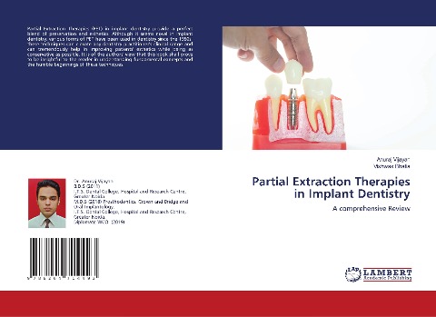 Partial Extraction Therapies in Implant Dentistry: A comprehensive Review