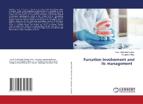 Furcation Involvement and its management