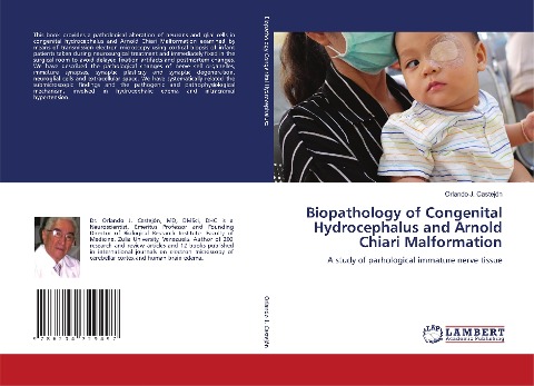 Biopathology of Congenital Hydrocephalus and Arnold Chiari Malformation: A study of parhological immature nerve tissue
