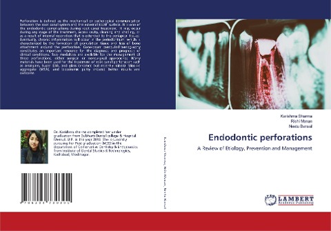 Endodontic perforations: A Review of Etiology, Prevention and Management