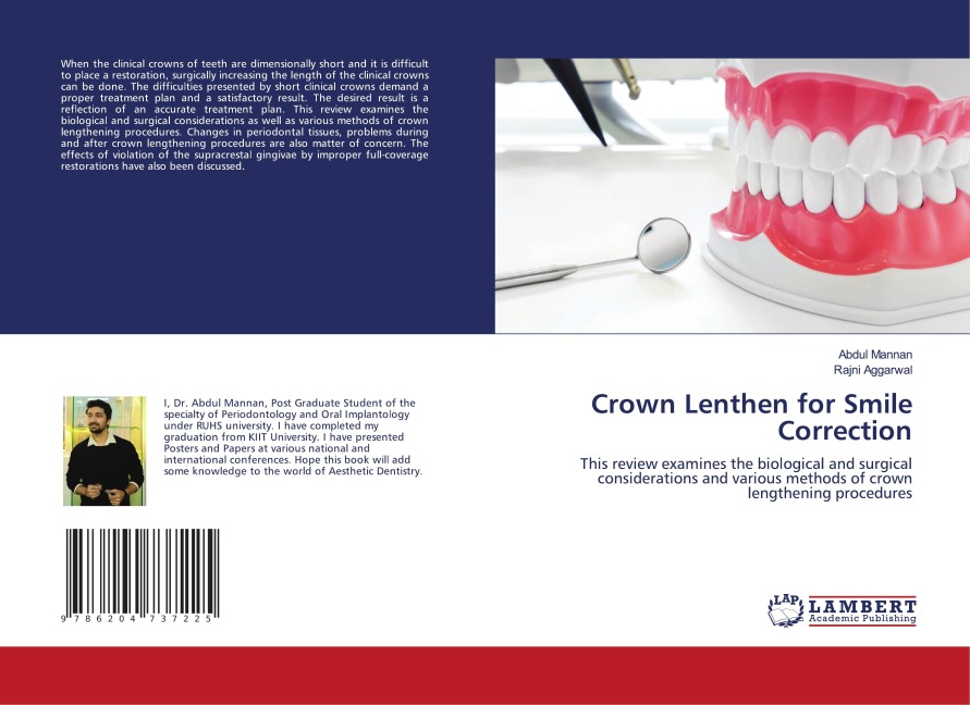 Crown Lenthen for Smile Correction: This review examines the biological and surgical considerations and various methods of crown lengthening procedures
