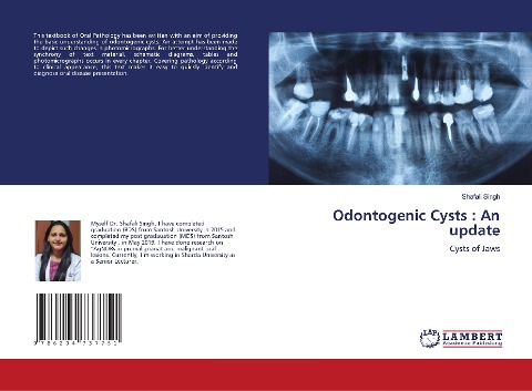 Odontogenic Cysts : An update: Cysts of Jaws