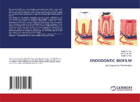 ENDODONTIC BIOFILM: An Enigma To The Dentist