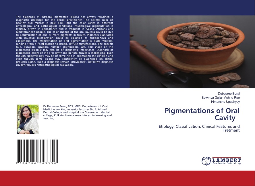 Pigmentations of Oral Cavity: Etiology, Classification, Clinical Features and Tretment