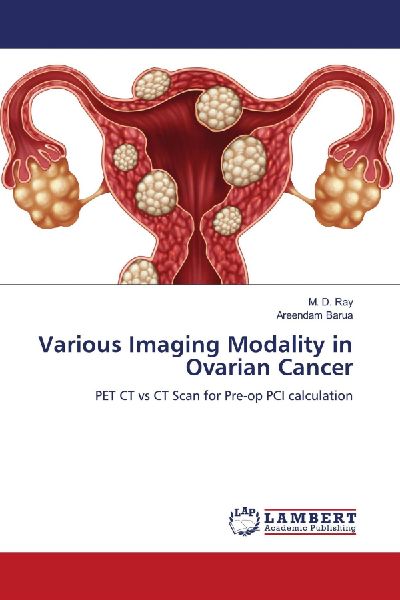 Various Imaging Modality in Ovarian Cancer: PET CT vs CT Scan for Pre-op PCI calculation