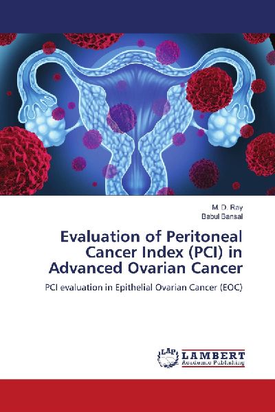 Evaluation of Peritoneal Cancer Index (PCI) in Advanced Ovarian Cancer: PCI evaluation in Epithelial Ovarian Cancer (EOC)