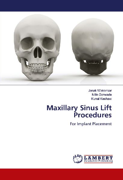 Maxillary Sinus Lift Procedures: For Implant Placement