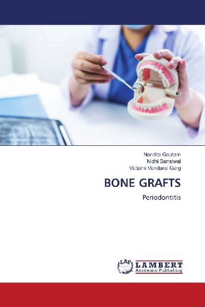 BONE GRAFTS: Periodontitis