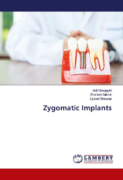 Zygomatic Implants