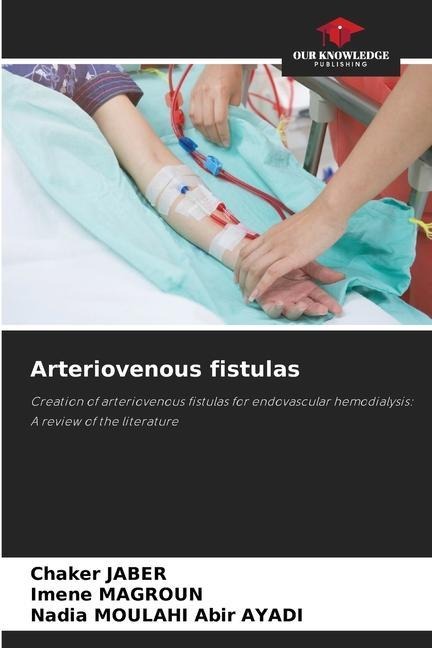 Arteriovenous fistulas: Creation of arteriovenous fistulas for endovascular hemodialysis: A review of the literature