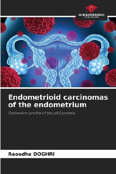 Endometrioid carcinomas of the endometrium: Expression profile of the p53 protein