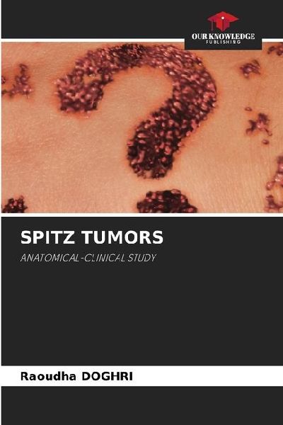 SPITZ TUMORS: ANATOMICAL-CLINICAL STUDY