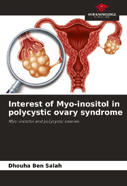 Interest of Myo-inositol in polycystic ovary syndrome: Myo-inositol and polycystic ovaries