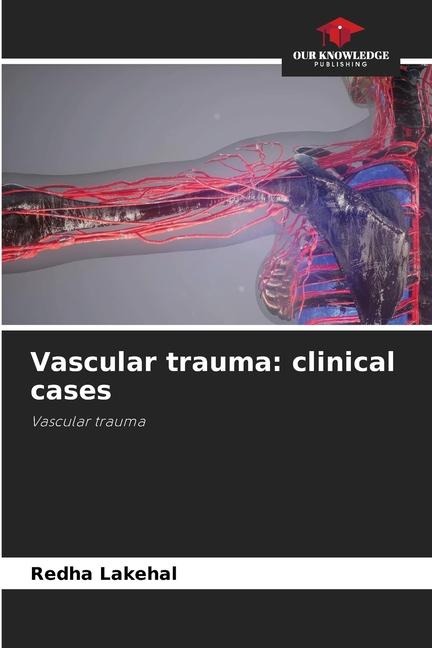 Vascular trauma: clinical cases: Vascular trauma