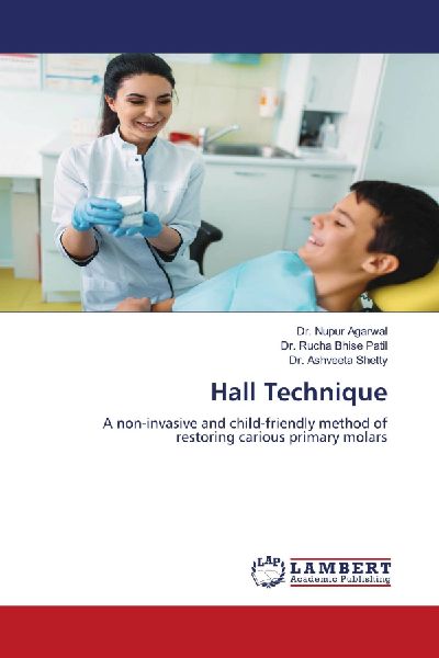 Hall Technique: A non-invasive and child-friendly method of restoring carious primary molars