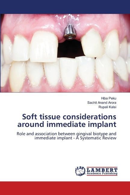 Soft tissue considerations around immediate implant: Role and association between gingival biotype and immediate implant - A Systematic Review