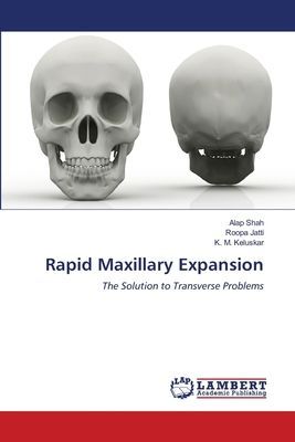 Rapid Maxillary Expansion: The Solution to Transverse Problems