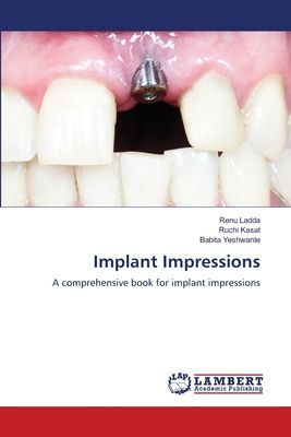 Implant Impressions: A comprehensive book for implant impressions