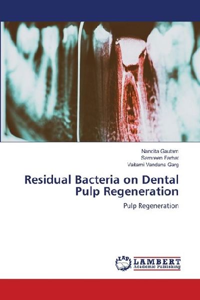 Residual Bacteria on Dental Pulp Regeneration: Pulp Regeneration