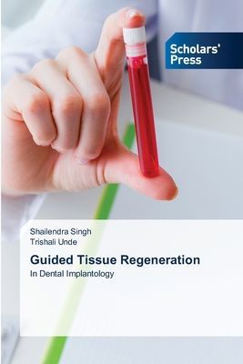 Guided Tissue Regeneration: In Dental Implantology
