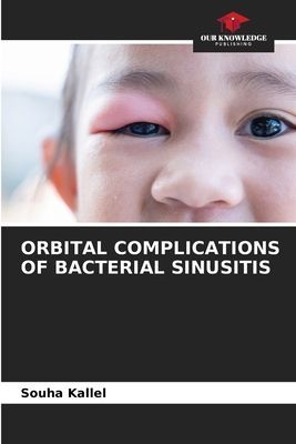 ORBITAL COMPLICATIONS OF BACTERIAL SINUSITIS