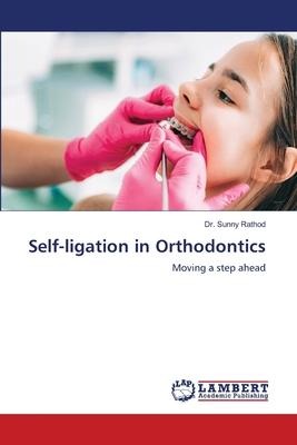 Self-ligation in Orthodontics: Moving a step ahead