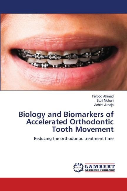 Biology and Biomarkers of Accelerated Orthodontic Tooth Movement: Reducing the orthodontic treatment time