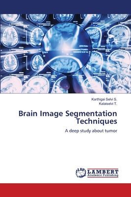 Brain Image Segmentation Techniques: A deep study about tumor