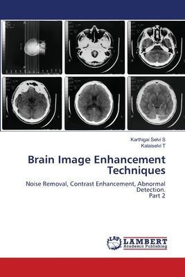 Brain Image Enhancement Techniques: Noise Removal, Contrast Enhancement, Abnormal Detection.Part 2