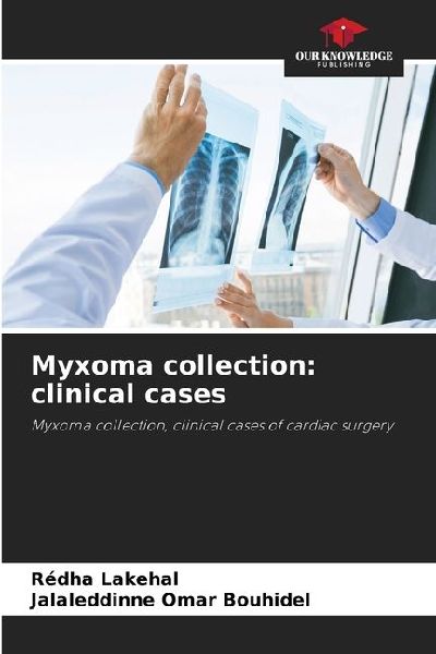 Myxoma collection: clinical cases: Myxoma collection, clinical cases of cardiac surgery