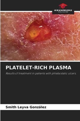 PLATELET-RICH PLASMA: Results of treatment in patients with phlebostatic ulcers.