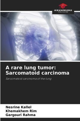 A rare lung tumor: Sarcomatoid carcinoma: Sarcomatoid carcinoma of the lung