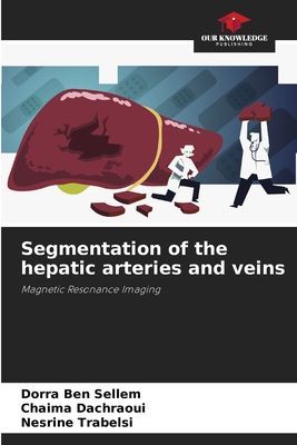 Segmentation of the hepatic arteries and veins: Magnetic Resonance Imaging