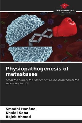 Physiopathogenesis of metastases: From the birth of the cancer cell to the formation of the secondary tumor