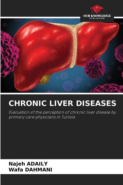 CHRONIC LIVER DISEASES: Evaluation of the perception of chronic liver disease by primary care physicians in Tunisia