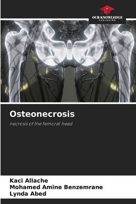Osteonecrosis: necrosis of the femoral head