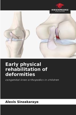 Early physical rehabilitation of deformities: congenital knee orthopedics in children