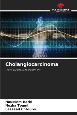 Cholangiocarcinoma: From diagnosis to treatment