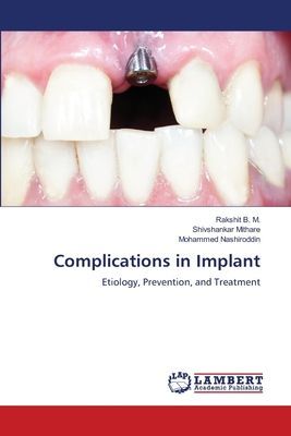 Complications in Implant: Etiology, Prevention, and Treatment