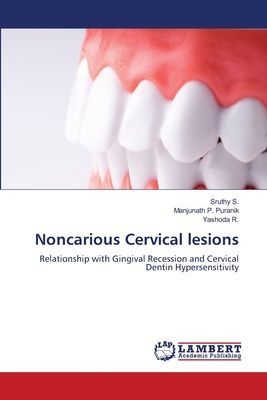 Noncarious Cervical lesions: Relationship with Gingival Recession and Cervical Dentin Hypersensitivity