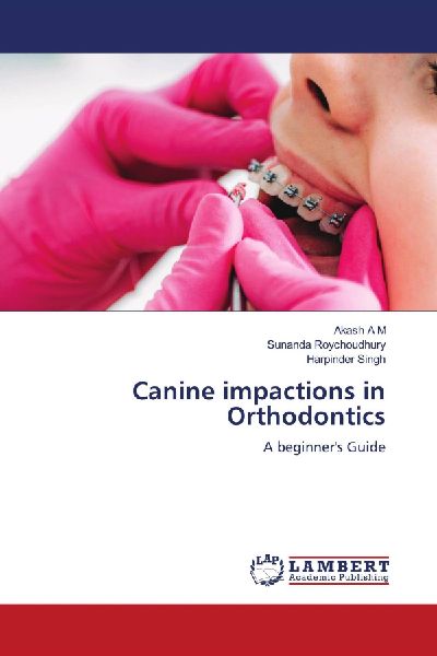 Canine impactions in Orthodontics: A beginners Guide