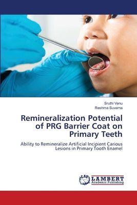 Remineralization Potential of PRG Barrier Coat on Primary Teeth: Ability to Remineralize Artificial Incipient Carious Lesions in Primary Tooth Enamel