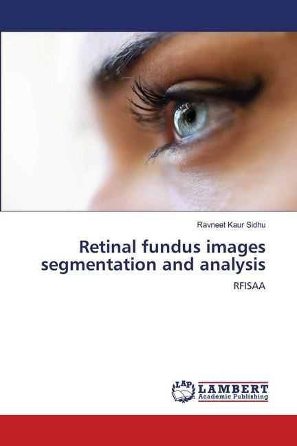 Retinal fundus images segmentation and analysis: RFISAA