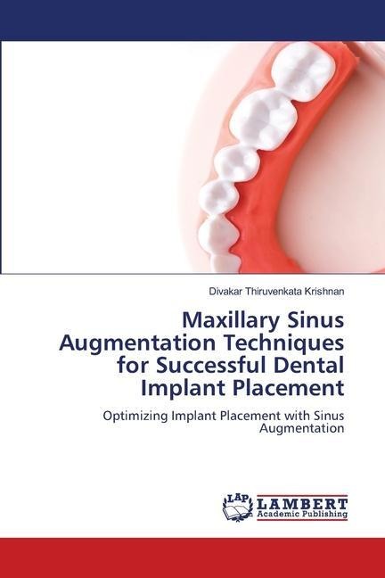 Maxillary Sinus Augmentation Techniques for Successful Dental Implant Placement: Optimizing Implant Placement with Sinus Augmentation