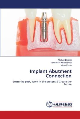 Implant Abutment Connection: Learn the past, Work in the present & Create the future
