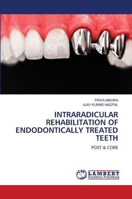 INTRARADICULAR REHABILITATION OF ENDODONTICALLY TREATED TEETH: POST & CORE