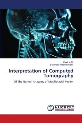 Interpretation of Computed Tomography: Of The Normal Anatomy of Maxillofacial Region