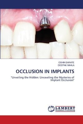 OCCLUSION IN IMPLANTS: Unveiling the Hidden: Unraveling the Mysteries of Implant Occlusion