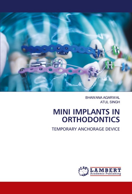 MINI IMPLANTS IN ORTHODONTICS: TEMPORARY ANCHORAGE DEVICE