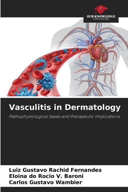 Vasculitis in Dermatology: Pathophysiological bases and therapeutic implications
